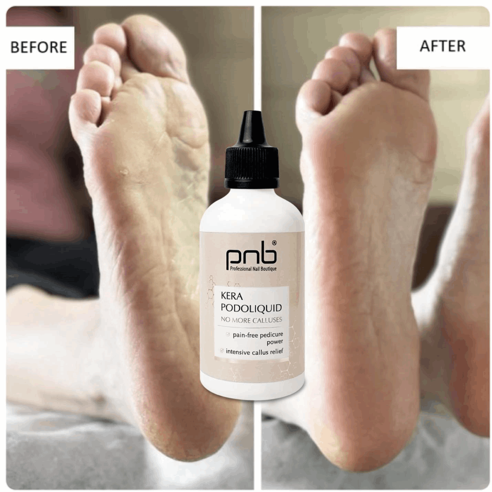 Pedicure PNB Kera Podoliquid 100 ml