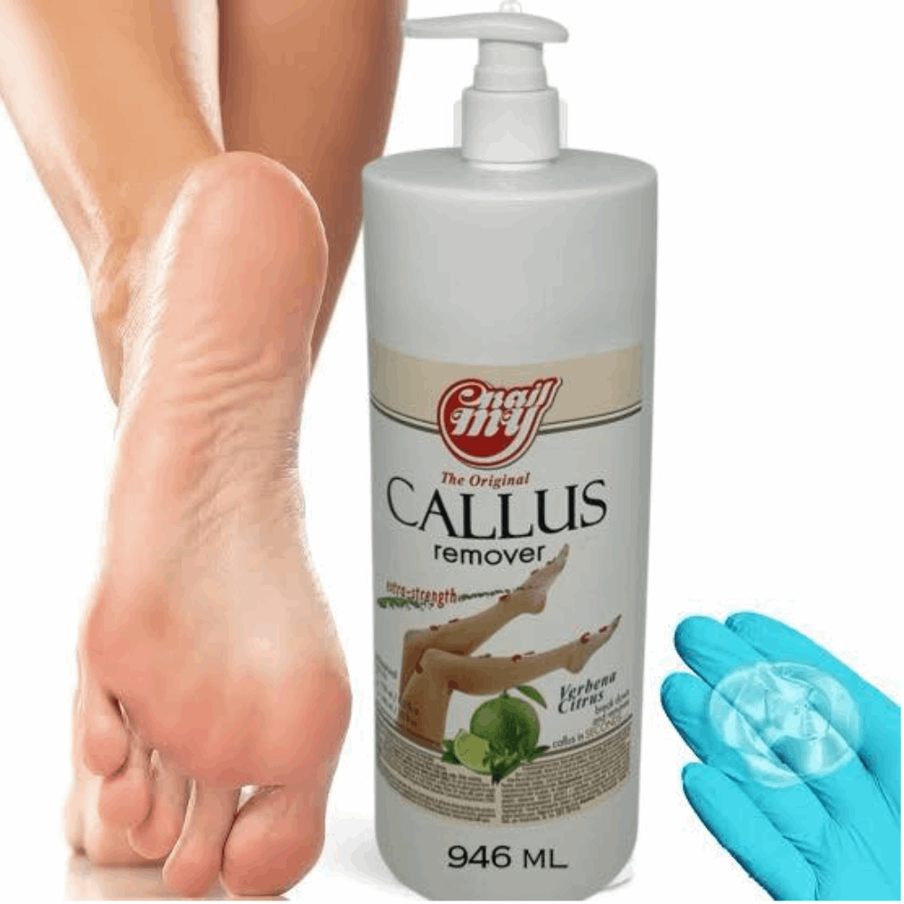 Pedicure My Nail Callus Remover 946 ml