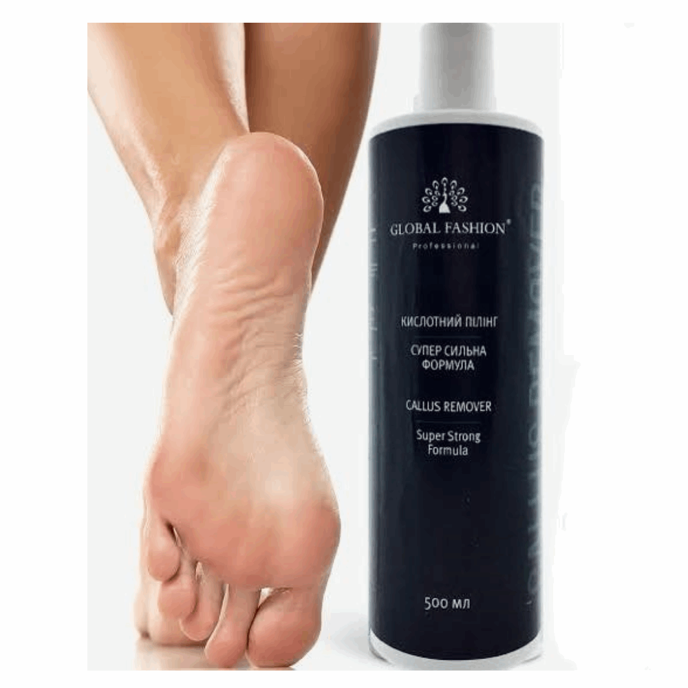 Global Fashion Callus Remover 500ML Global Fashion Callus Remover 500ML